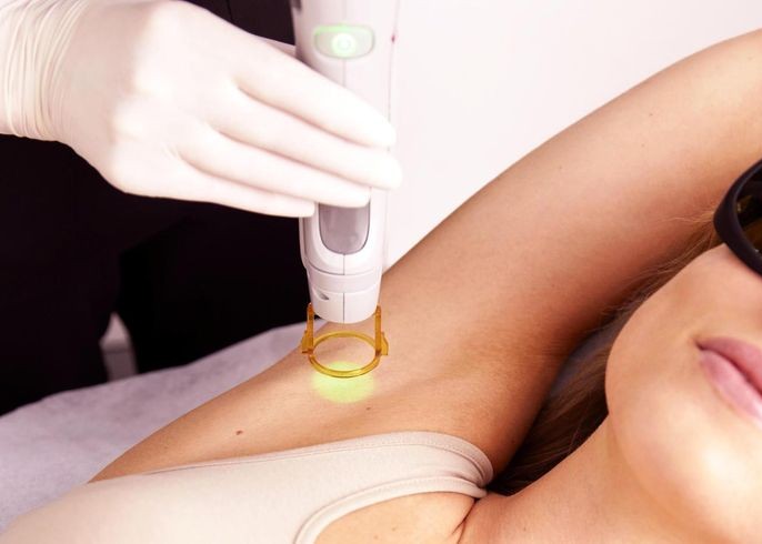 Underarm Carbon Peel Laser